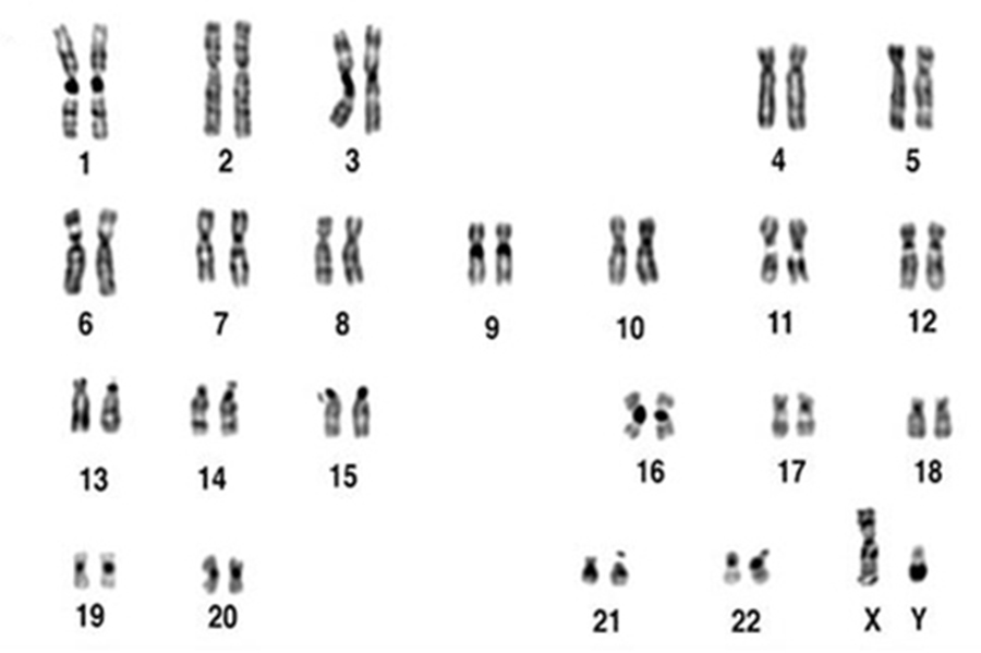 Human Chromosomes