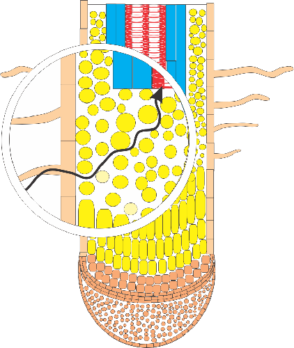 root